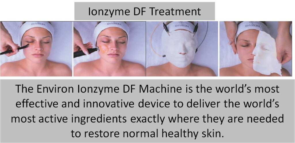 A chart showing the steps in Ionzyme DF Treatment. [312573]
